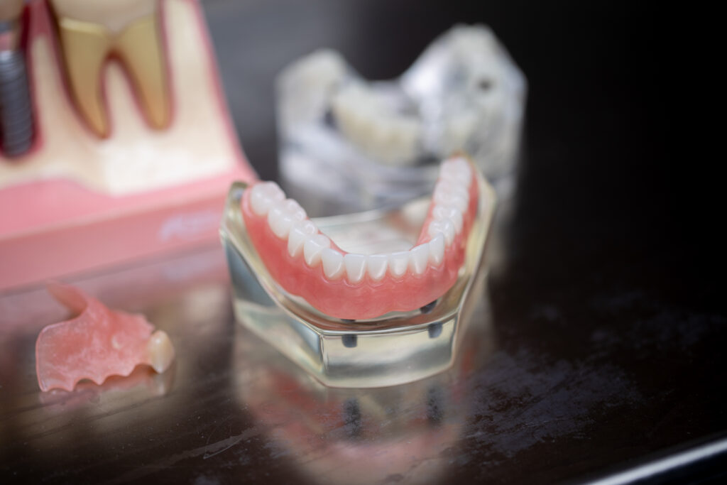 dental models