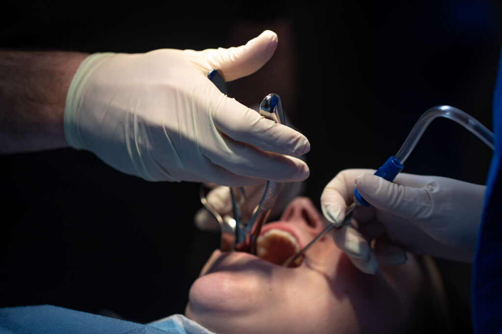 person with their mouth open having oral surgery performed