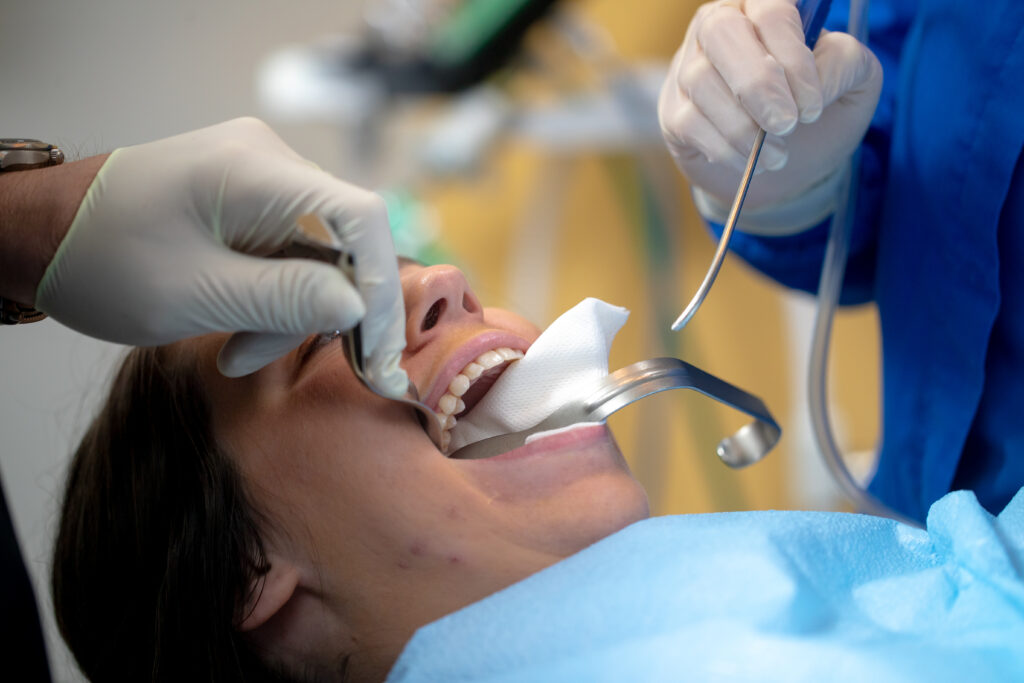 woman with her mouth open during oral surgery