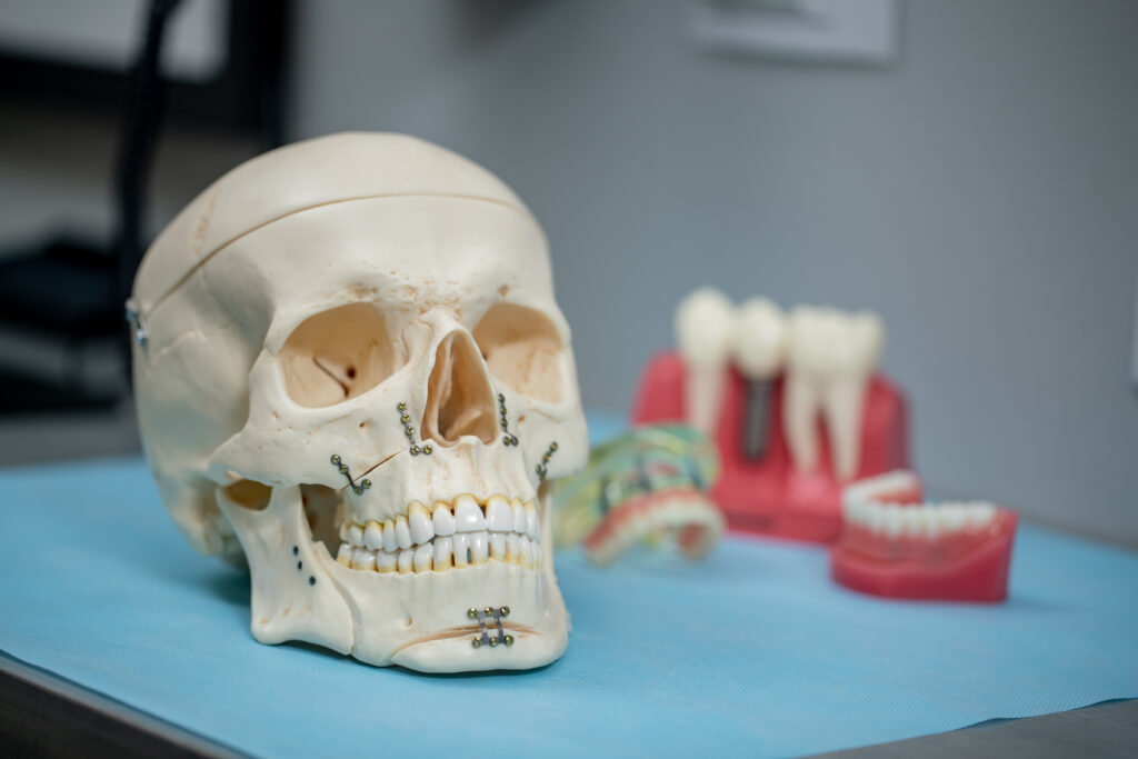 skull and dental implant models