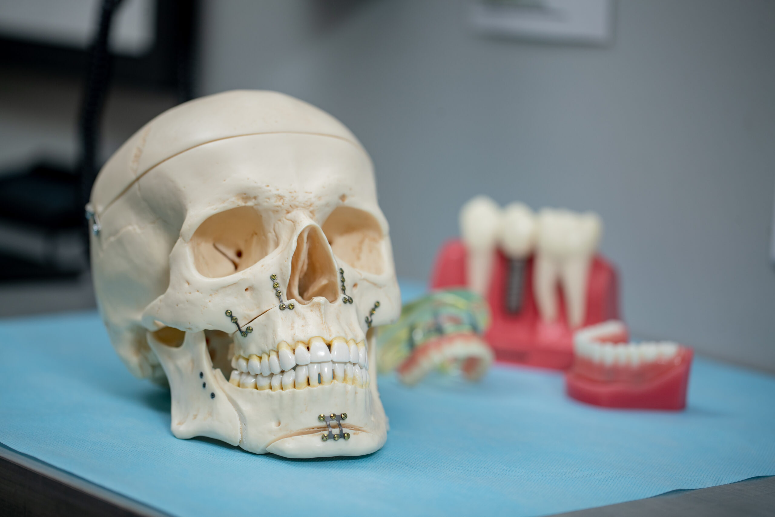 skull and dental implant models