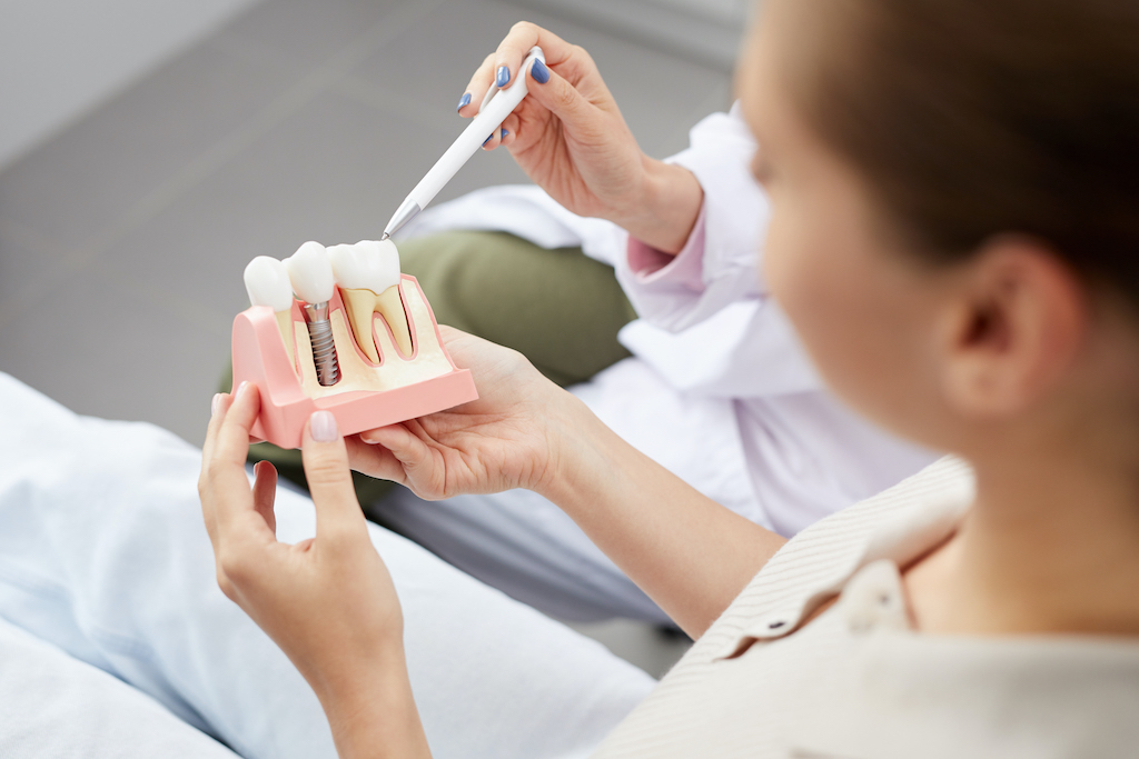 surgeon pointing to a model of a dental implant in a patient's hand