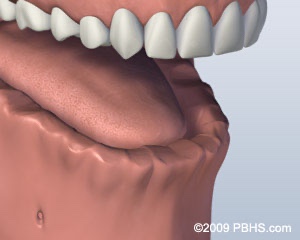 graphic of lower jaw missing all teeth