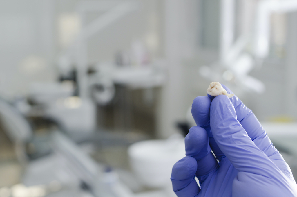 gloved hand holding an extracted tooth